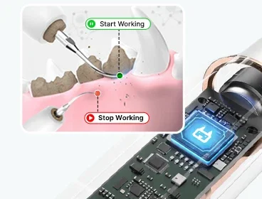 DentoFix gum detection: the tip works on the tooth and stops when it touches the gum